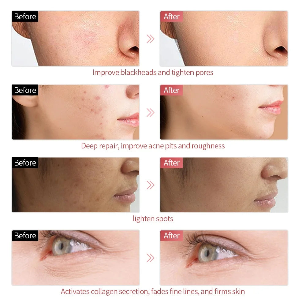 7-Color LED Facial Mask