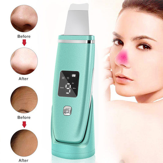 Ultrasonic Facial Scrubber Blackhead Remover